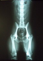 Hip X-ray